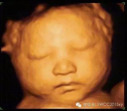 孕晚期多少周停止补钙(孕后期要停止补钙吗)-硒宝网