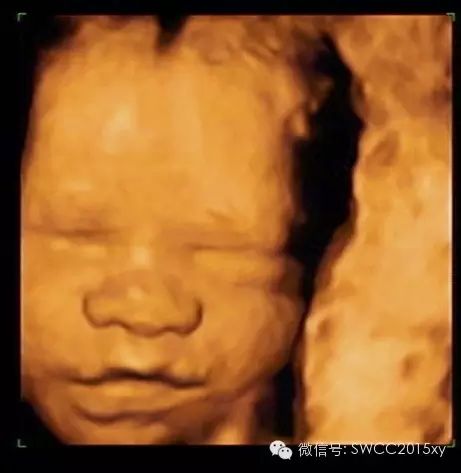 孕晚期多少周停止补钙(孕后期要停止补钙吗)-硒宝网