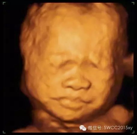 孕晚期多少周停止补钙(孕后期要停止补钙吗)-硒宝网