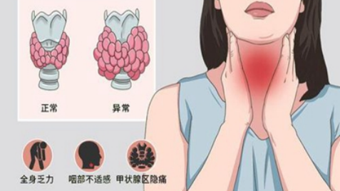 甲亢要补硒和维生素b（甲亢补充硒有效果吗）-硒宝网