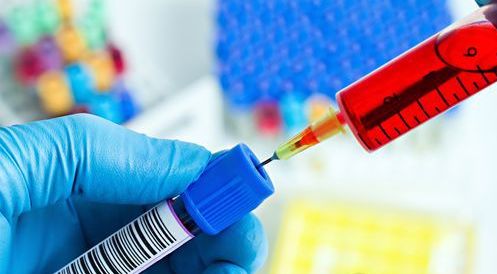 抽血化验微量元素要空腹吗（微量元素抽血空腹吗）-硒宝网