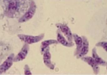 腰间盘突出需要补硒吗（腰椎间盘突出用补钙吗）-硒宝网