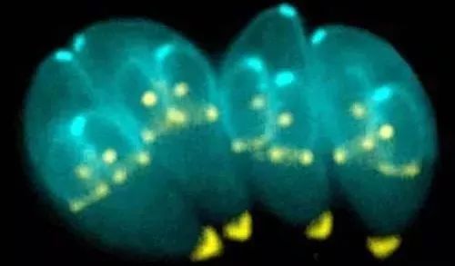 腰间盘突出需要补硒吗（腰椎间盘突出用补钙吗）-硒宝网