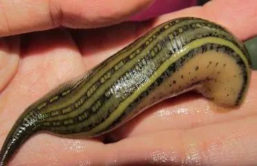 鼻咽癌要补硒吗为什么(硒对鼻咽癌有帮助吗)-硒宝网