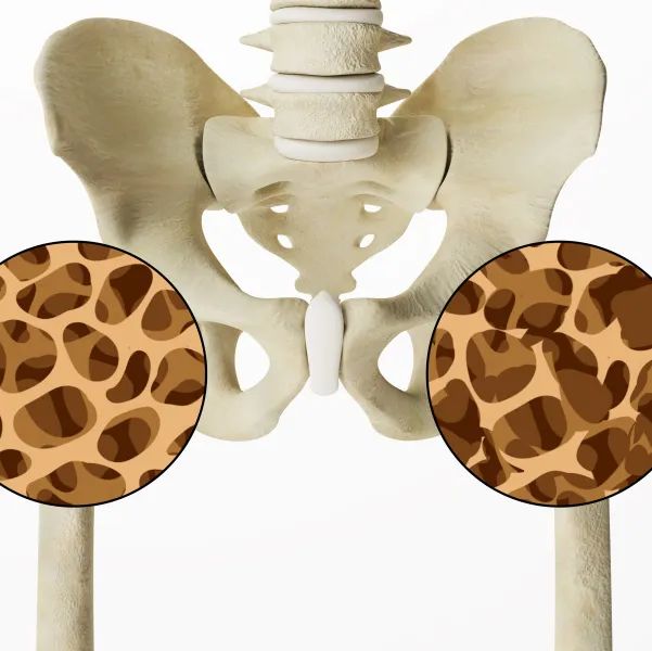 大骨头补钙吗(骨头补钙的食物有哪些)-硒宝网