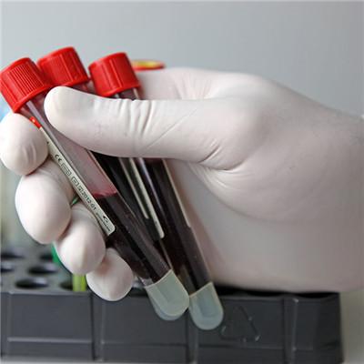 什么东西可以补铁(东西补铁可以长高吗)-硒宝网