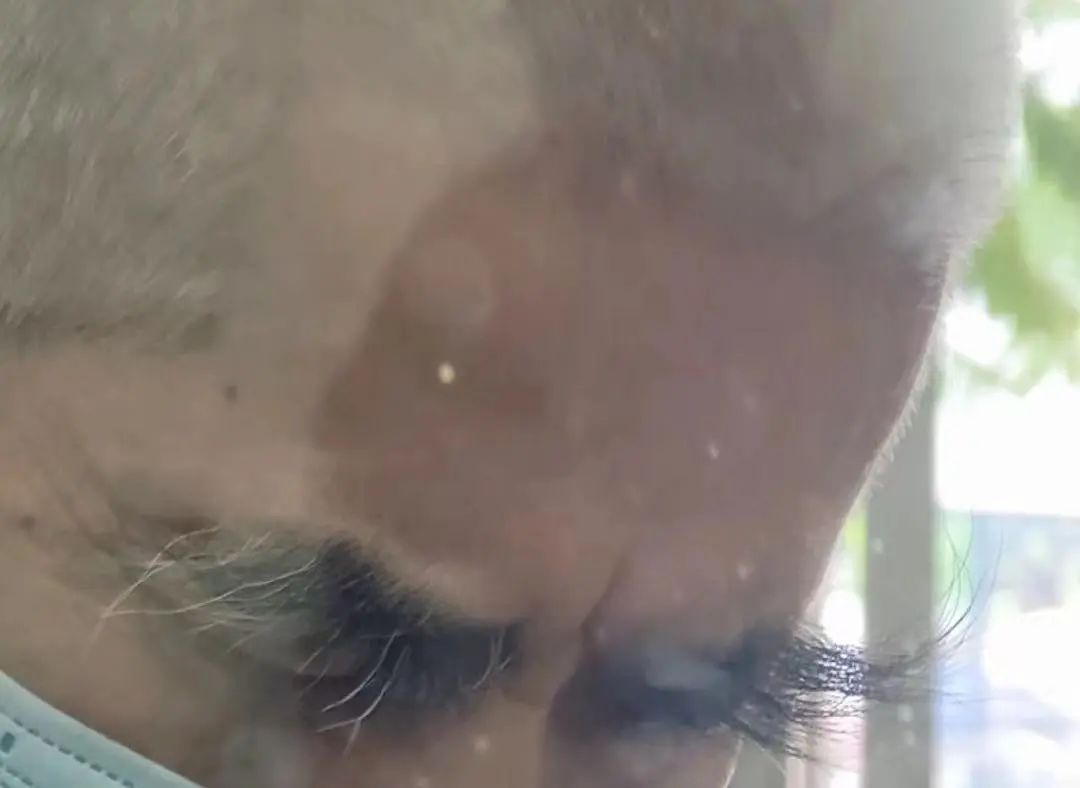 甲减吃补硒的药能行吗(甲减补硒要补多长时间)-硒宝网