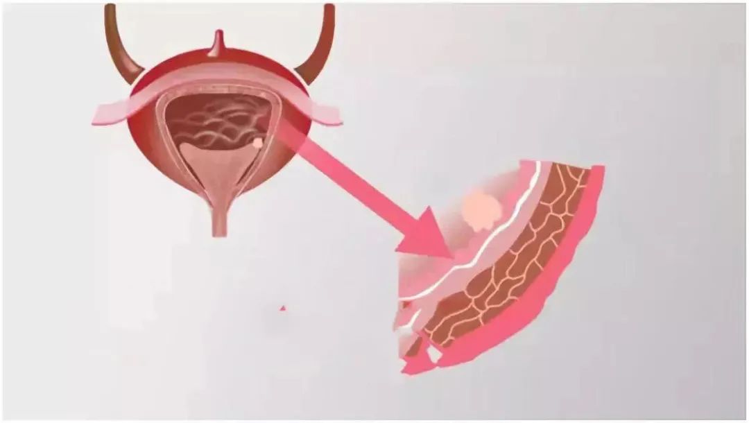 甲减吃补硒的药能行吗(甲减补硒要补多长时间)-硒宝网