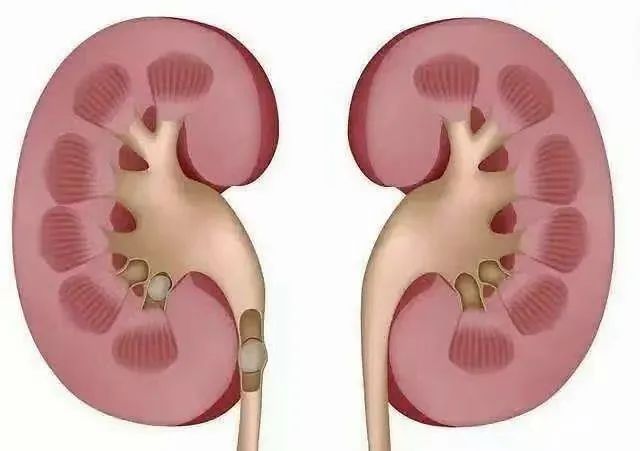 胆结石能补钙吗(胆结石补钙好吗)-硒宝网