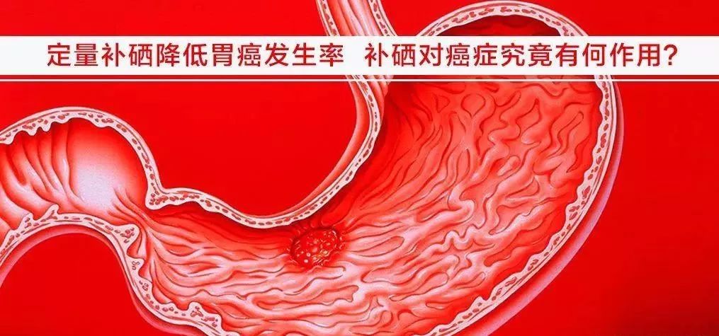 补硒能不能预防食管癌（硒食管癌）-硒宝网