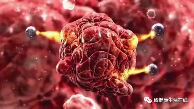 补硒能不能预防食管癌(补硒能有效的预防)-硒宝网