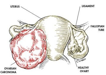 畸胎瘤手术后能补硒吗(畸胎瘤手术后能吃西瓜吗)-硒宝网