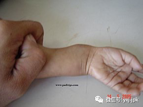 儿童要补钙吗(儿童补钙需要补到几岁)-硒宝网