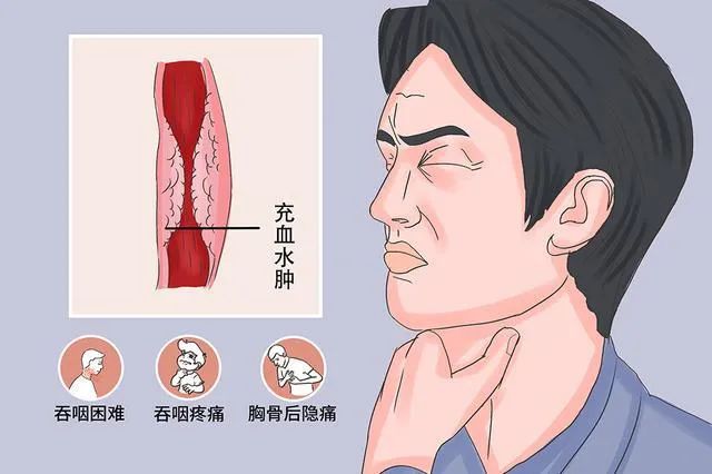 防癌补硒用哪一款好呢（补硒防什么癌）-硒宝网