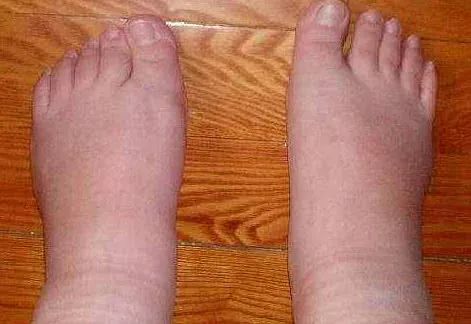 牛用的补硒的药有哪些（牛补硒过量多长时间出现反应）-硒宝网