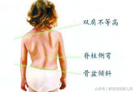 一岁半宝宝缺硒怎么补(宝宝缺硒吃什么药)-硒宝网