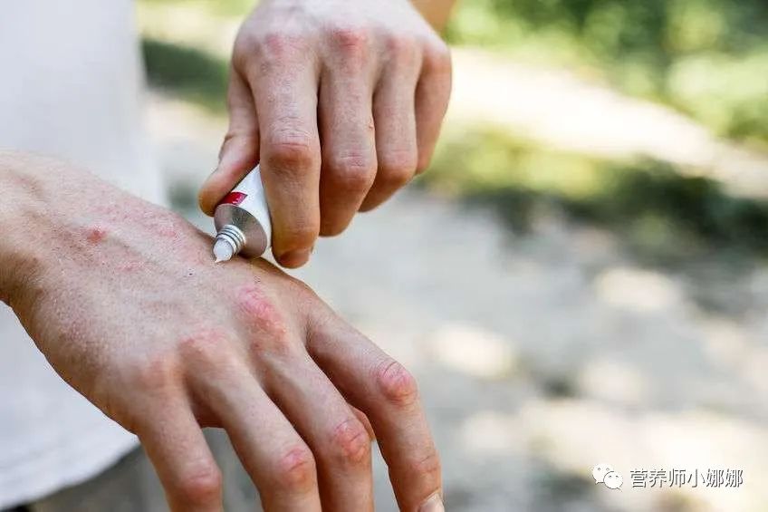 脂溢性皮炎补硒有用吗（硒酵母片脂溢性皮炎）-硒宝网