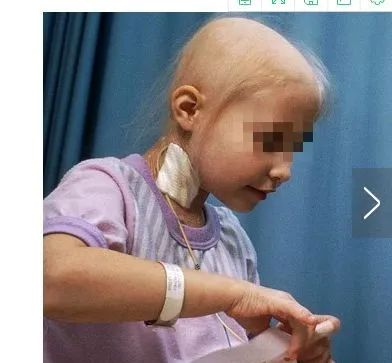 前列腺癌吃什么补硒好(补硒前列腺)-硒宝网