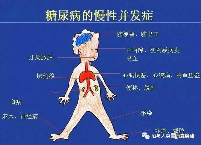 糖尿病人可长期补硒吗（补硒对糖尿病人有什么好处）-硒宝网