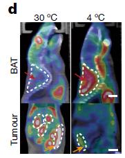 给癌症病人补硒可以吗（癌症能补硒）-硒宝网