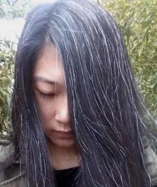 孩子有白头发是缺少什么微量元素(少白头不缺微量元素)-硒宝网