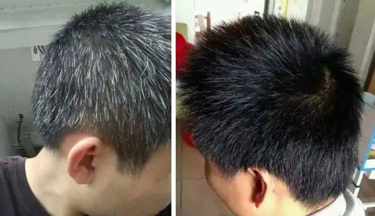 孩子有白头发是缺少什么微量元素(少白头不缺微量元素)-硒宝网