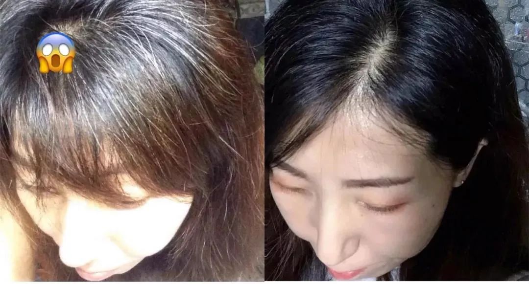 孩子有白头发是缺少什么微量元素(少白头不缺微量元素)-硒宝网