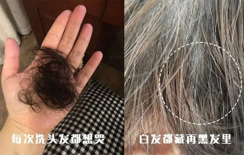 孩子有白头发是缺少什么微量元素(少白头不缺微量元素)-硒宝网