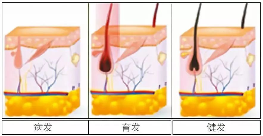 孩子有白头发是缺少什么微量元素(少白头不缺微量元素)-硒宝网