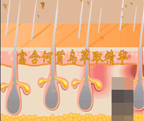 孩子有白头发是缺少什么微量元素(少白头不缺微量元素)-硒宝网