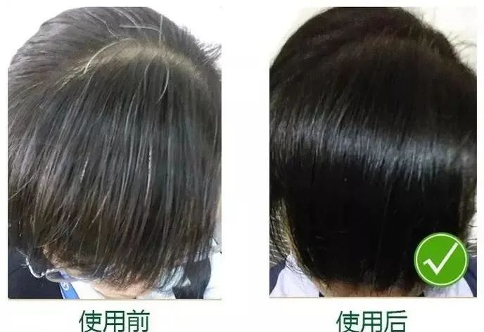 孩子有白头发是缺少什么微量元素(少白头不缺微量元素)-硒宝网