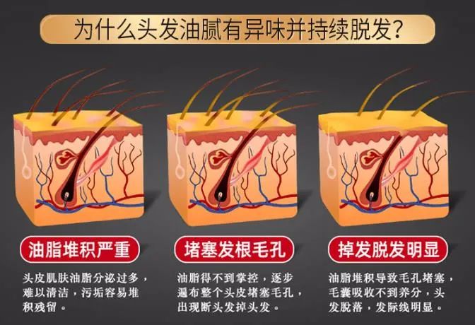 孩子有白头发是缺少什么微量元素(少白头不缺微量元素)-硒宝网