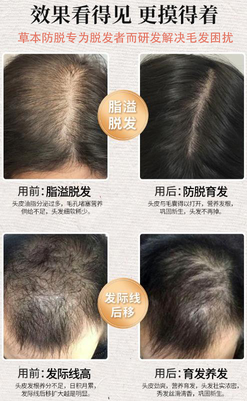 孩子有白头发是缺少什么微量元素(少白头不缺微量元素)-硒宝网