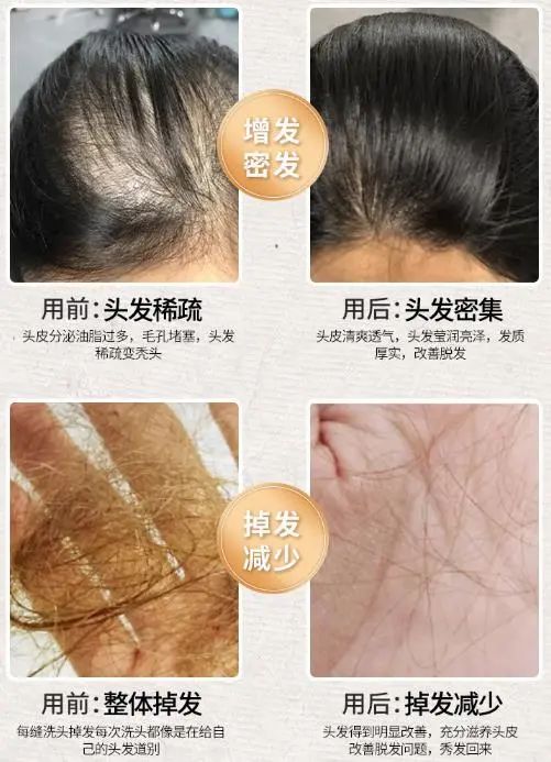 孩子有白头发是缺少什么微量元素(少白头不缺微量元素)-硒宝网