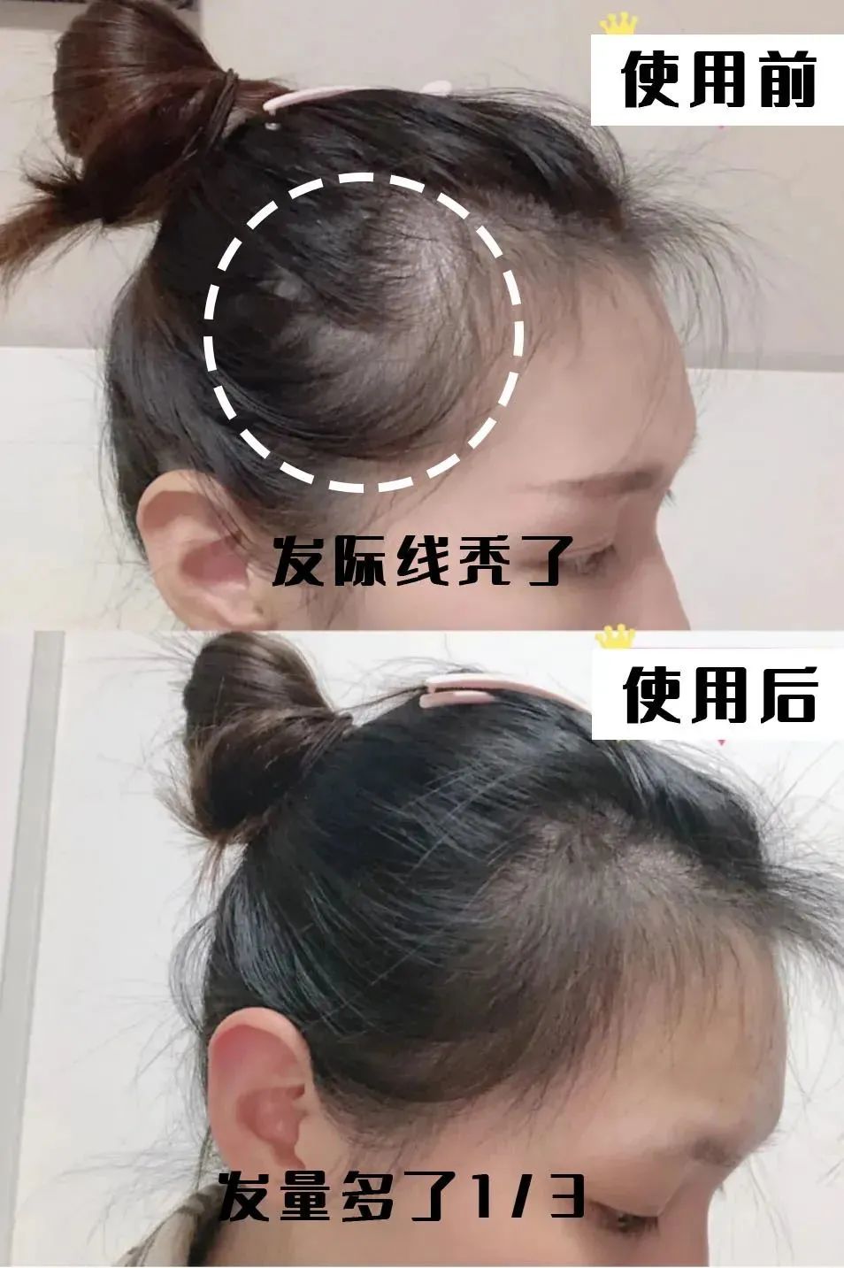 孩子有白头发是缺少什么微量元素(少白头不缺微量元素)-硒宝网