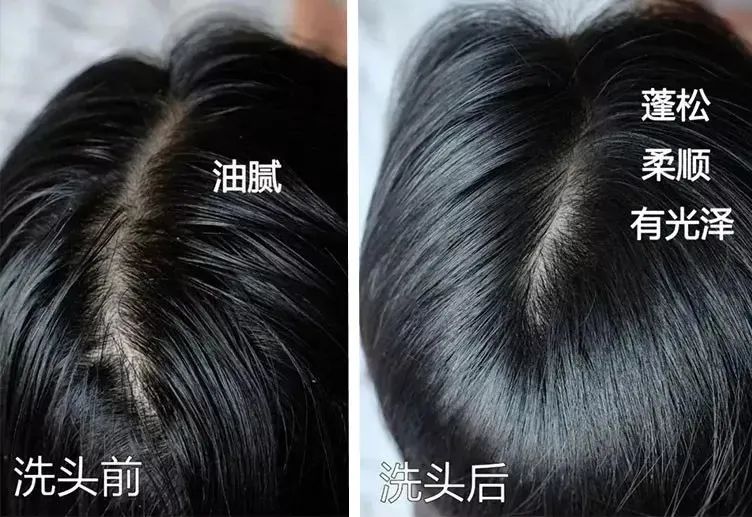 孩子有白头发是缺少什么微量元素(少白头不缺微量元素)-硒宝网