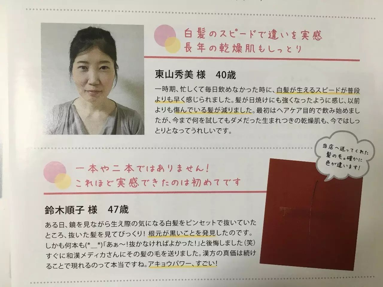 孩子有白头发是缺少什么微量元素（缺微量元素引起的白发多久能好）-硒宝网