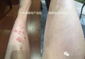 吃补硒的药能喝酵素吗(硒酵素片可以吃吗)-硒宝网