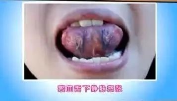 小度补硒的药怎么样吃（补充硒的药）-硒宝网