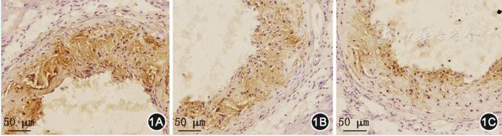 什么样的情况下要补硒（补硒建议）-硒宝网