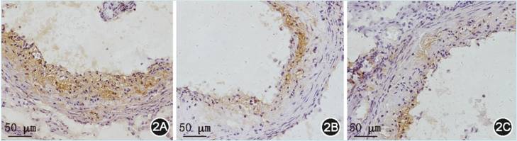 什么样的情况下要补硒（补硒建议）-硒宝网