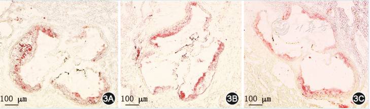 什么样的情况下要补硒（补硒建议）-硒宝网