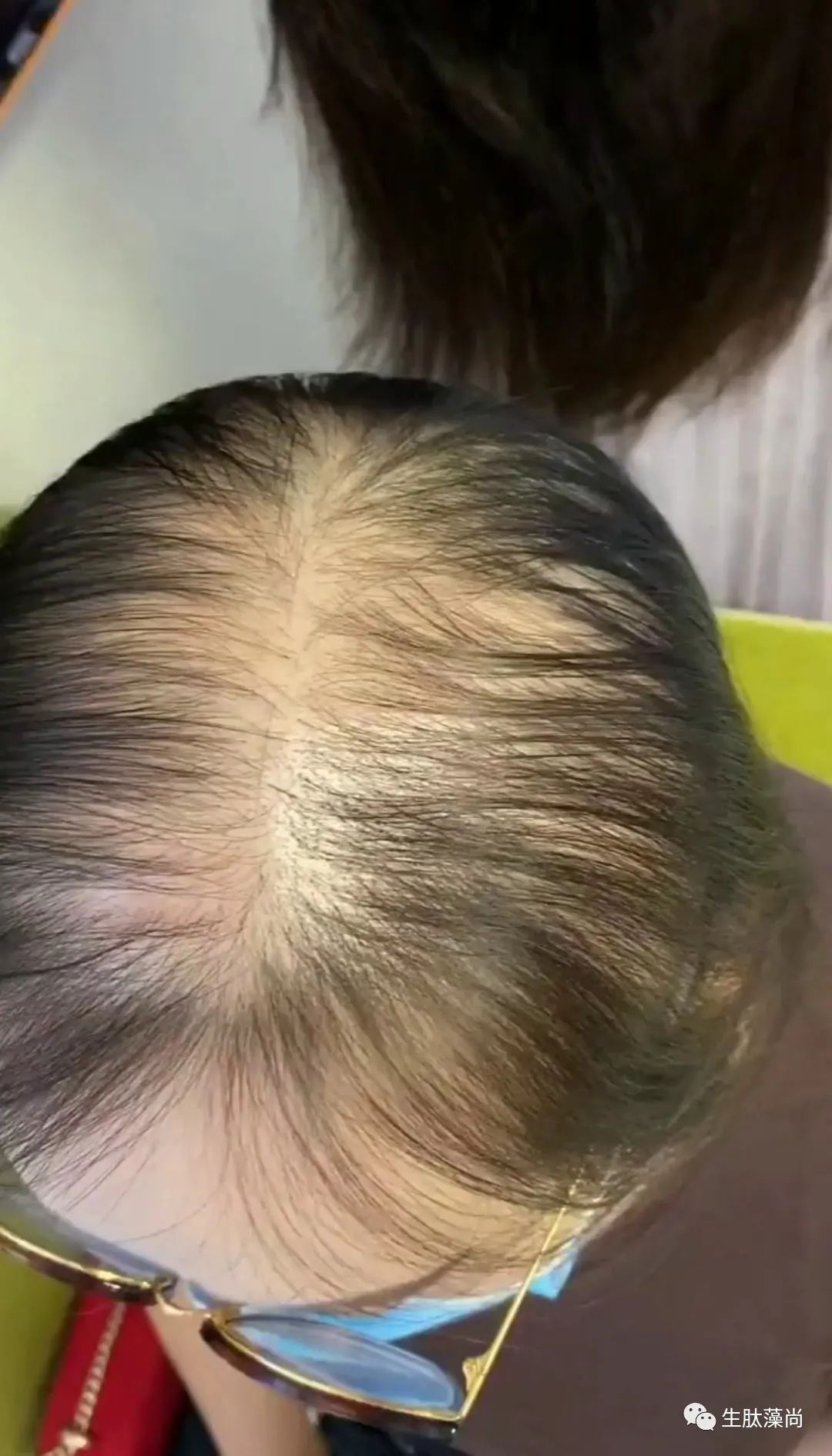 看一看补硒对人的好处(补硒的好处)-硒宝网