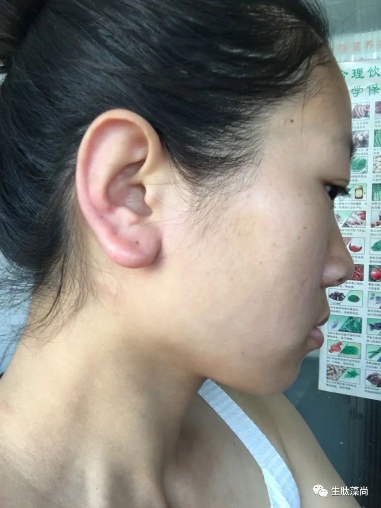 看一看补硒对人的好处(补硒的好处)-硒宝网