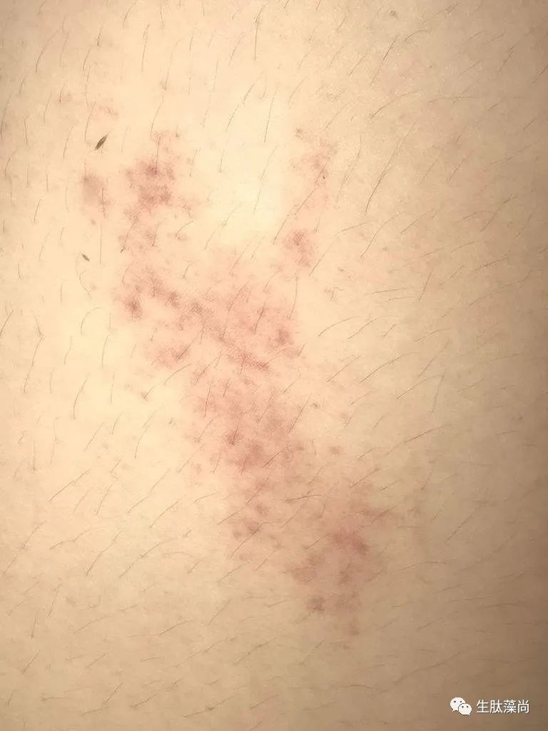 看一看补硒对人的好处(补硒的好处)-硒宝网