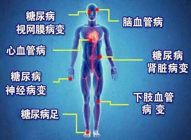 糖尿病心肌病患者补硒（糖尿病人补硒）-硒宝网