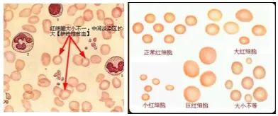 孕妇必须补铁吗(孕妇补铁药)-硒宝网
