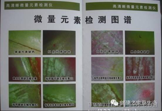 慢性溃疡性结肠炎补硒(溃疡慢性结肠炎可以多吃什么)-硒宝网