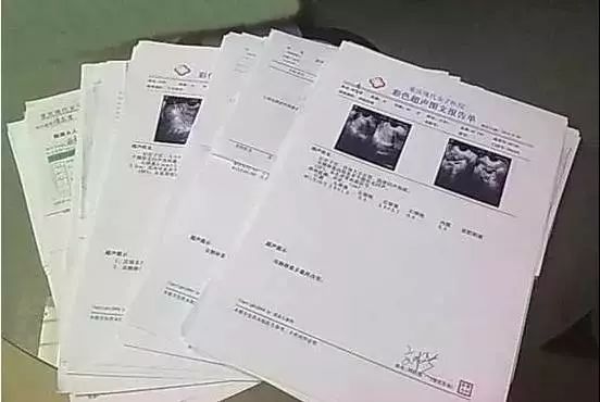 糖尿病补硒多少钱一盒(补硒能治糖尿病吗)-硒宝网