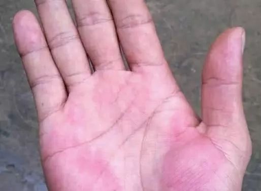 富硒产品不升高血糖吗（富硒降血糖）-硒宝网